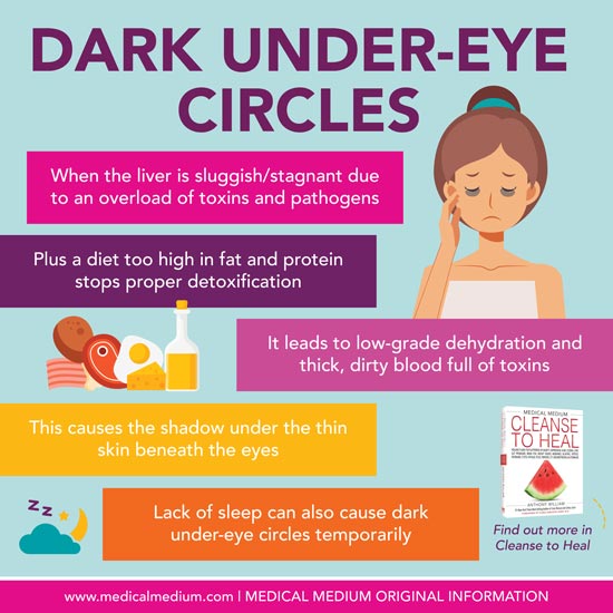 4 Unexpected Things That May Be Causing Under-Eye Bags
