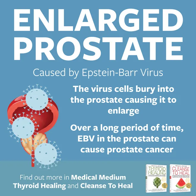 Enlarged Prostate
