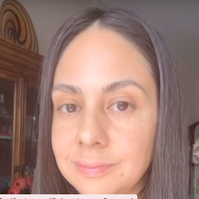 How I Transformed My Lifelong Skin Issues